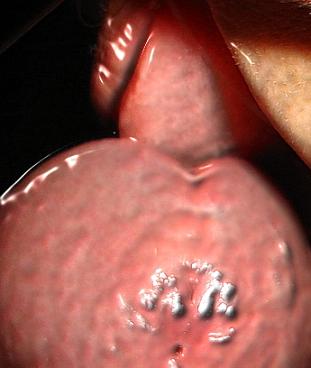 20070219161038-latex.jpg